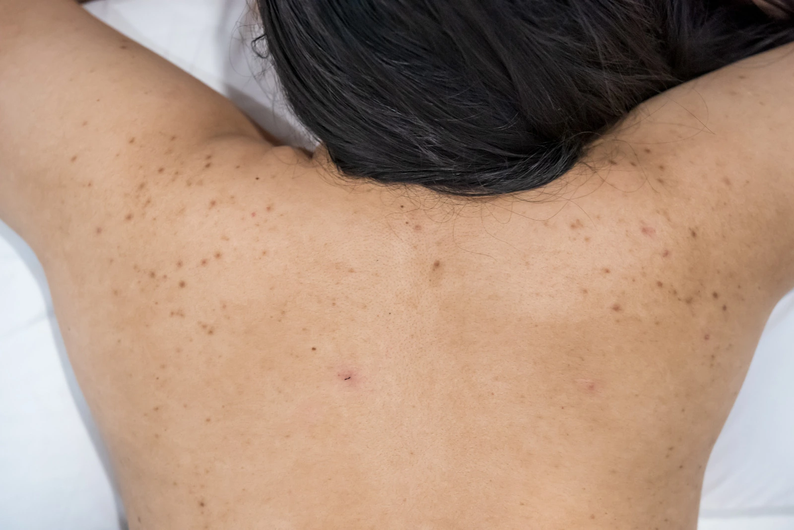 Body Skin Texture