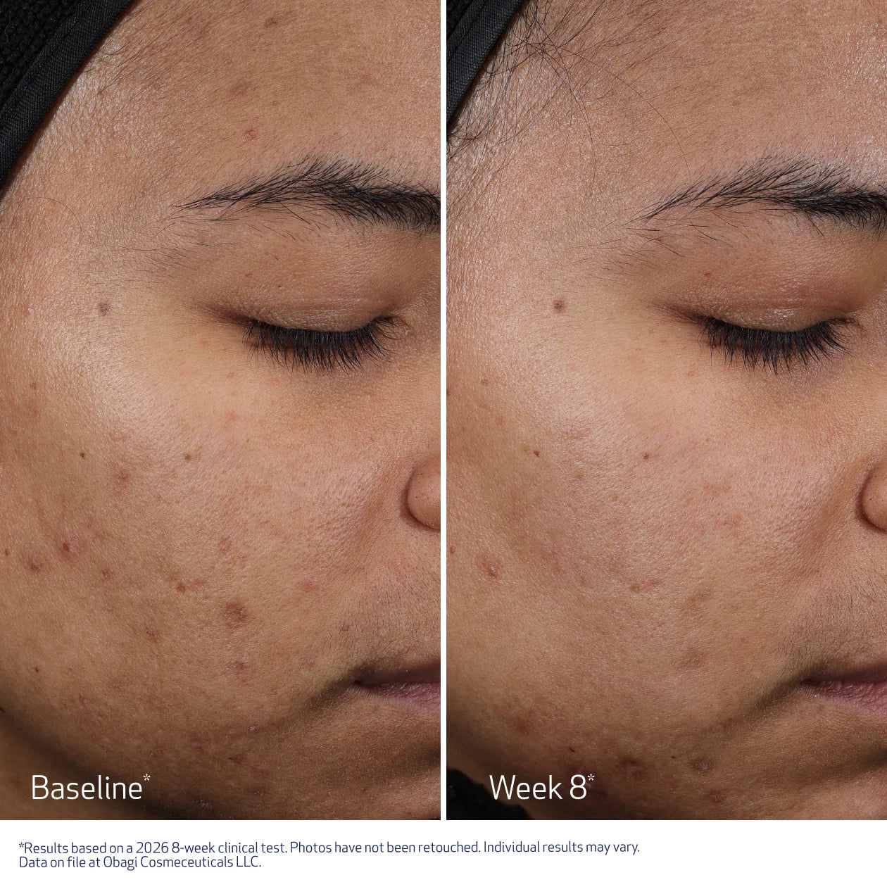 CLENZIDERM M.D. Resurfacing Multi-Acid Peel Pads - Image 6
