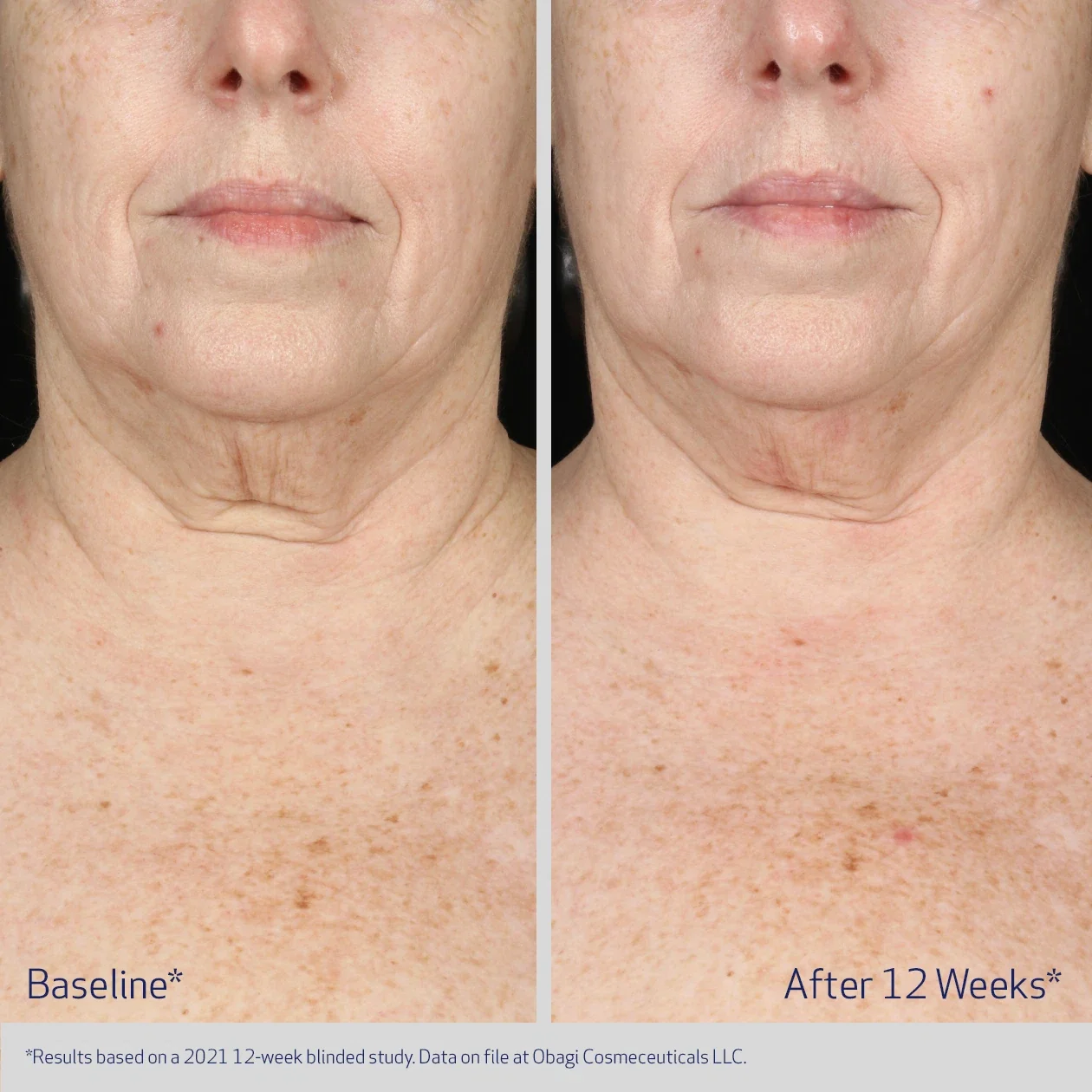 ELASTIderm Neck and Décolleté Concentrate 60ml - Image 4