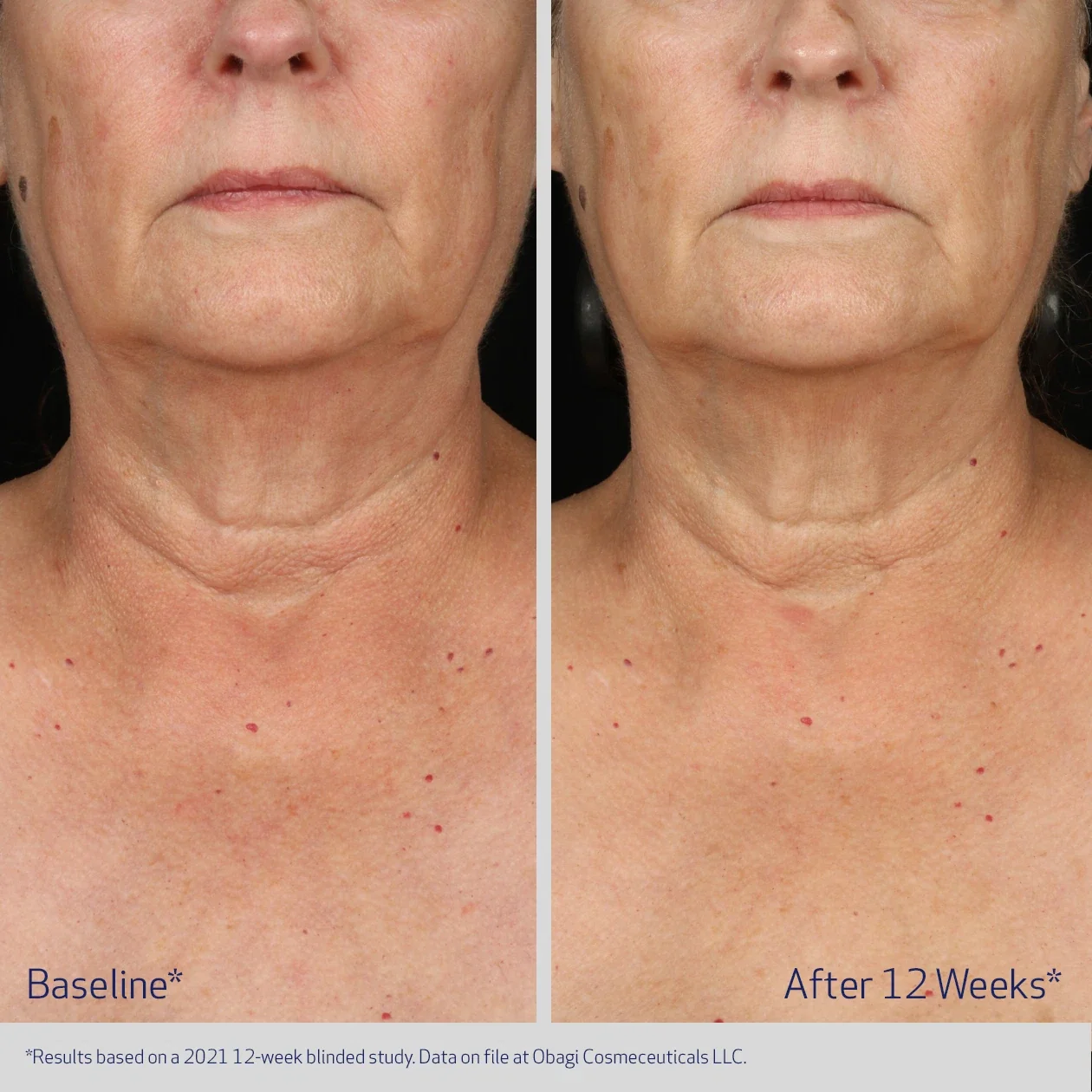 ELASTIderm Neck and Décolleté Concentrate 60ml - Image 5