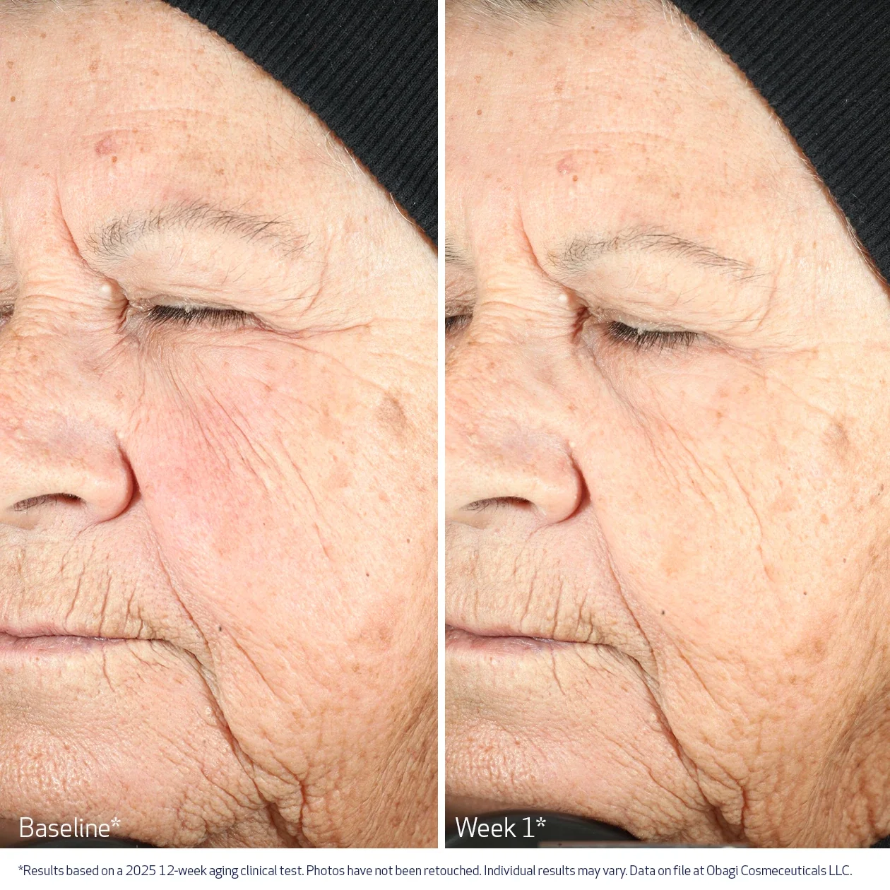 NU-GEN™ Cellular Renewal Serum 30ml - Image 3