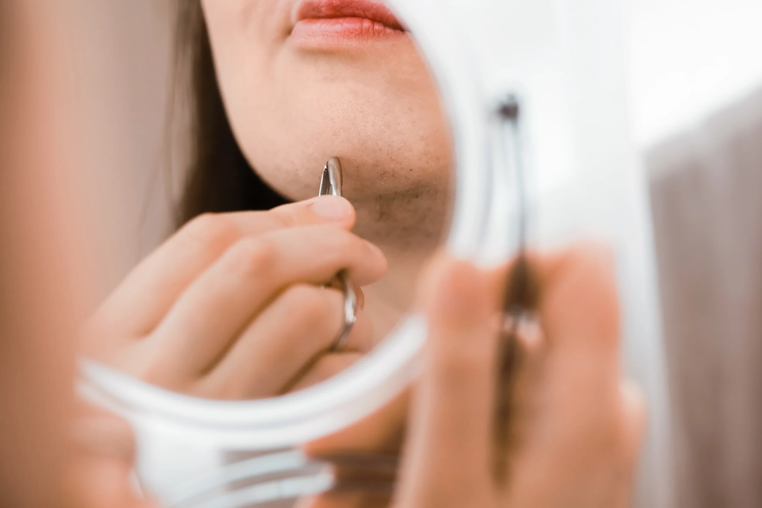 PCOS & Hormonal Skin