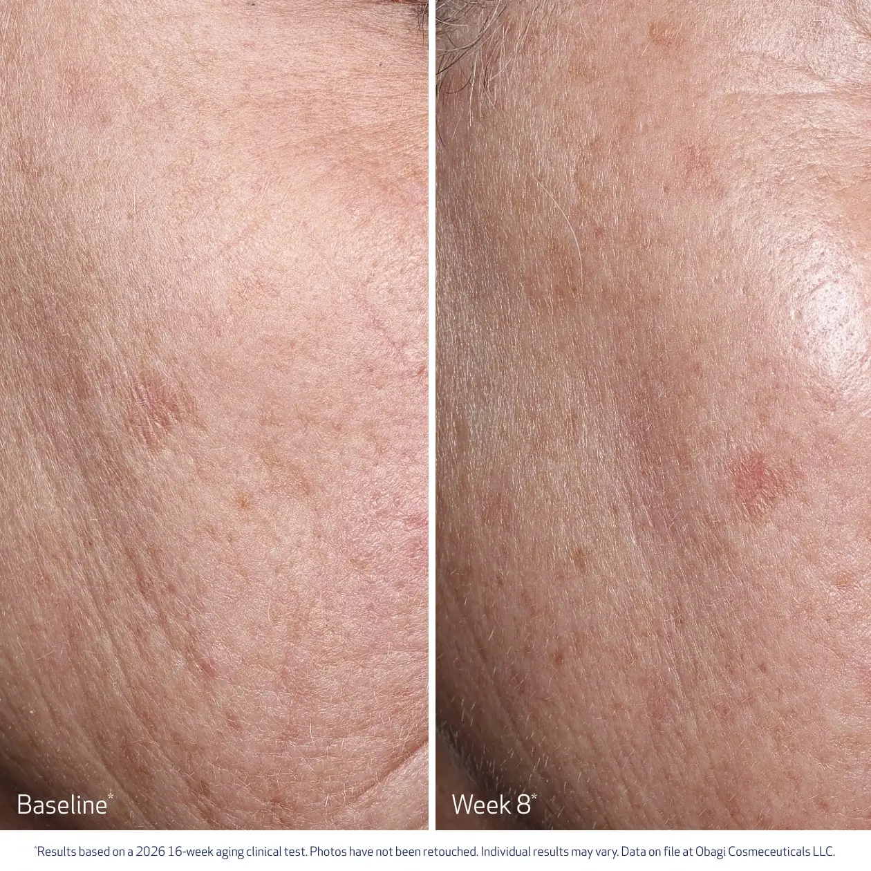 Professional-C Serum 20% 30ml - Image 6