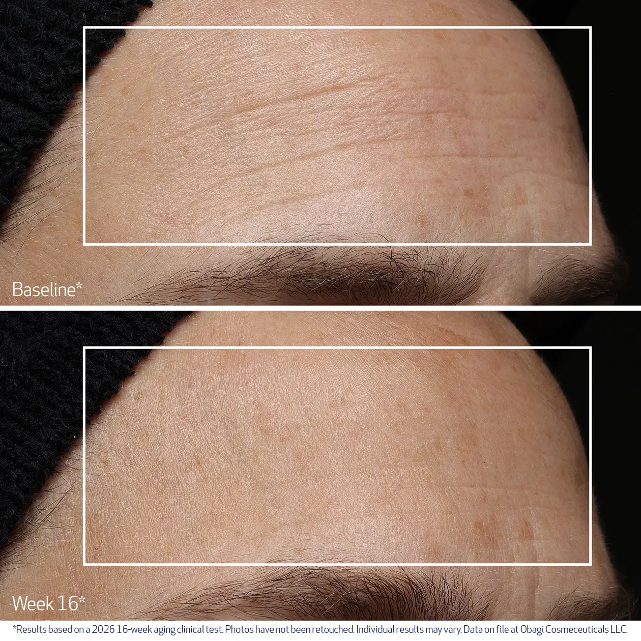 Professional-C Serum 20% 30ml - Image 5