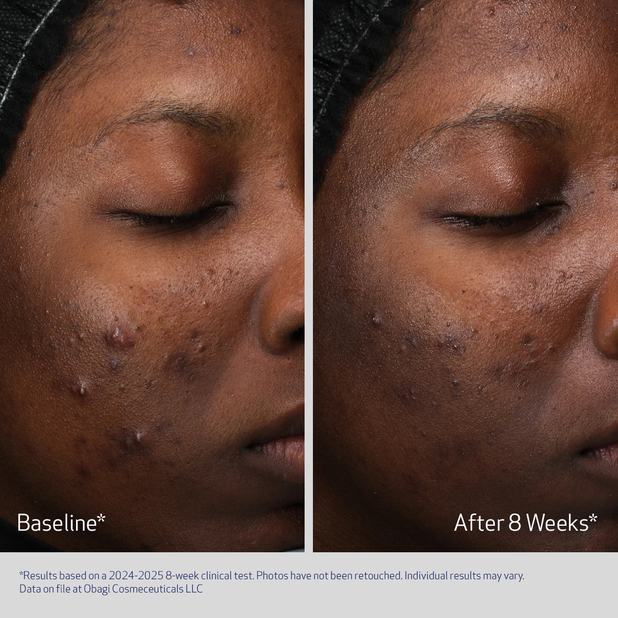 Retinol + PHA Refining Night Cream 50ml - Image 5