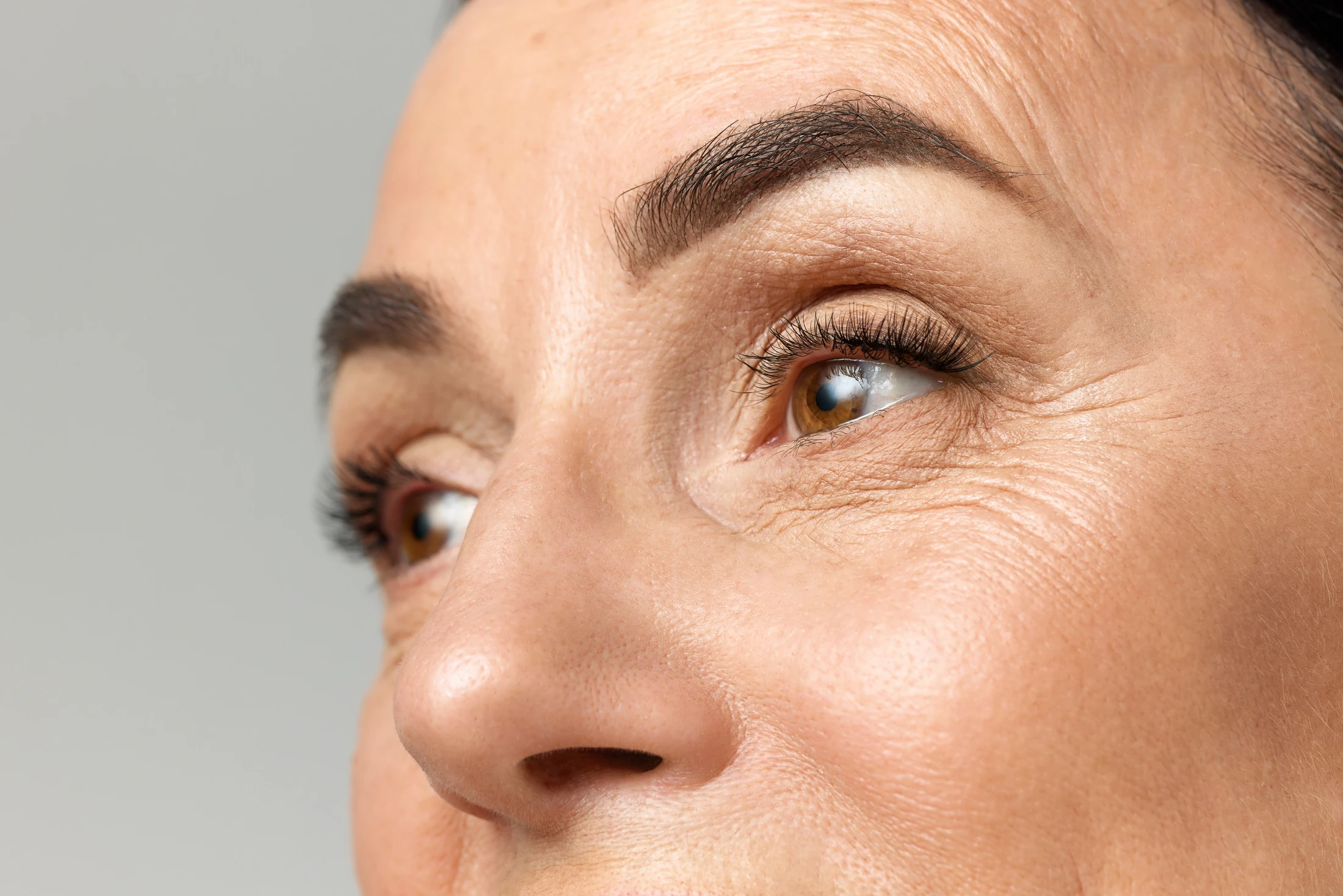 Fine Lines & Wrinkles